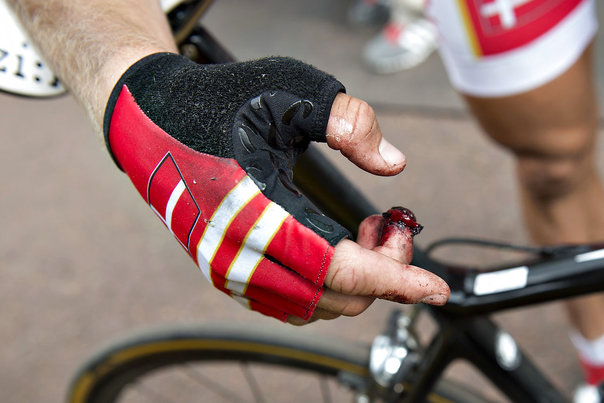 Matti Breschel var efter OLs linieløb bekymret for sin finger. Foto: Henning Bagger